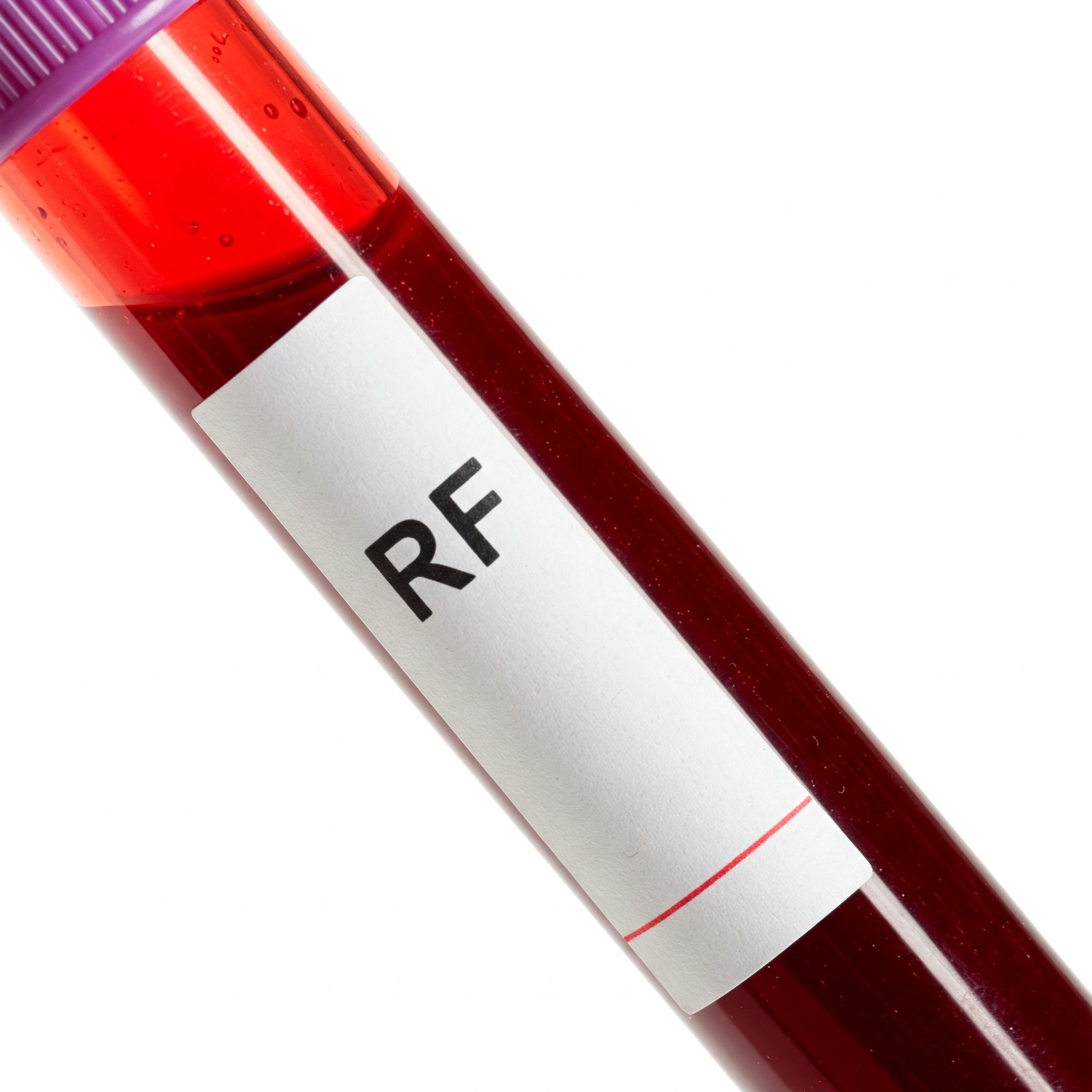 RHEUMATOID FACTOR (RF):