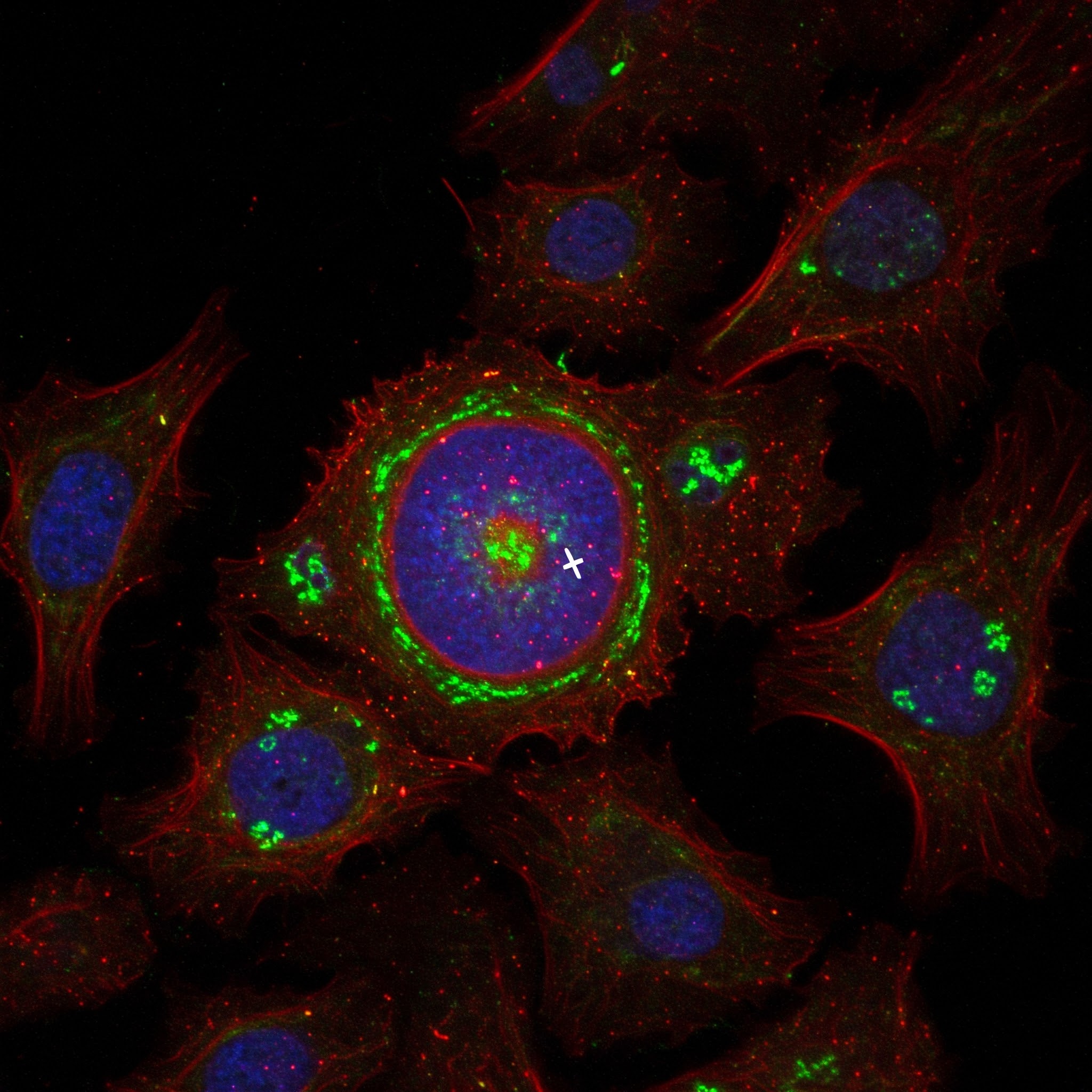 ANTINUCLEAR ANTIBODY (ANA)